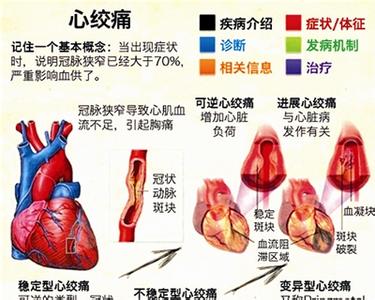 引起心绞痛的原因 引起心绞痛的几个主要原因