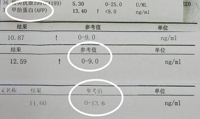 血清甲胎蛋白正常值 血清甲胎蛋白的正常值