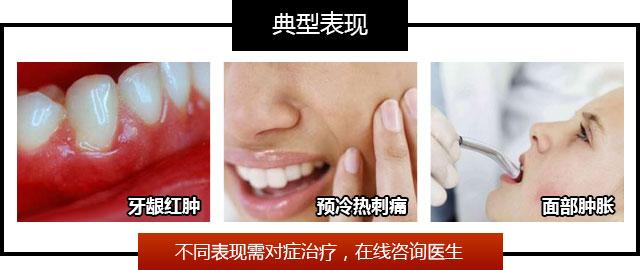 牙齿矫正有什么危害 牙齿经常疼痛有什么危害
