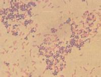 葡萄球菌感染用什么药 什么是葡萄球菌感染 葡萄球菌感染简介