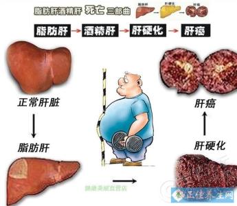 肝脏保养方法 怎么养好肝脏 养好肝脏的方法