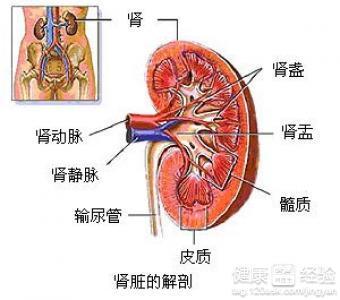 肾积水的表现 肾积水是怎样形成的 肾积水的表现和治疗