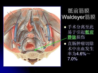 直肠肿瘤 直肠肿瘤是怎样形成的 直肠肿瘤有什么表现