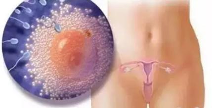 子宫囊肿是怎么形成的 子宫囊肿是怎么形成的 子宫囊肿如何防治