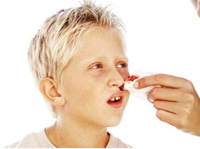 流鼻血是什么病的前兆 孩子经常流鼻血是什么原因