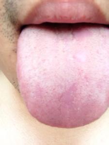 舌苔厚白是怎么回事 舌苔发白是怎么回事