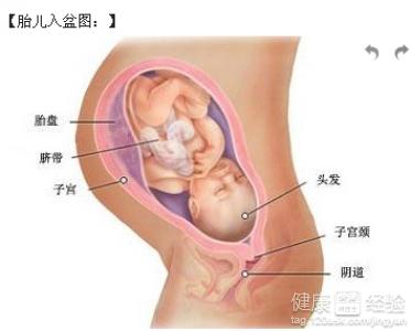 帮助胎儿入盆的运动图 胎儿不入盆与缺少运动有关吗