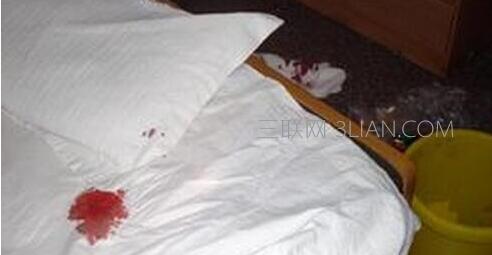 床单上有血迹怎么擦掉 床单上的血迹怎么洗