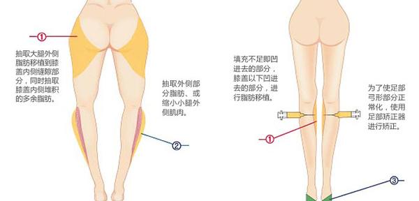 瘦小腿最有效的方法图 瘦小腿最有效的方法