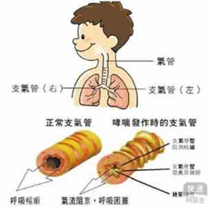 支气管哮喘的临床表现 哮喘是怎样形成的 哮喘的表现和治疗(2)