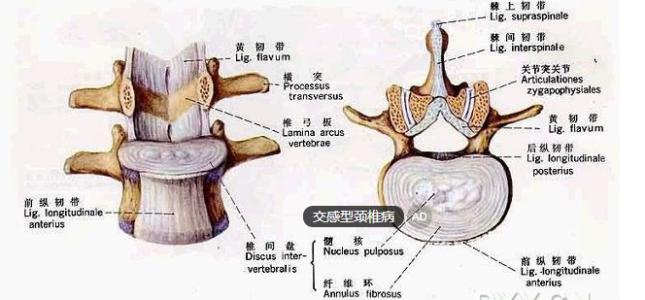 怎么方法治疗颈椎病好 颈椎病是怎么形成的 颈椎病的治疗方法