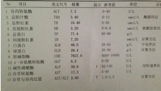 女性肝功能异常的表现 肝功能不正常有什么表现