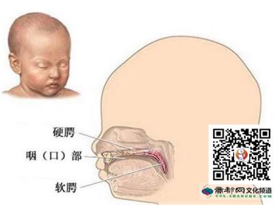 唇腭裂是什么时候形成 唇腭裂是怎么形成的