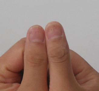 指甲上的月牙代表什么 指甲上有白点是怎么回事