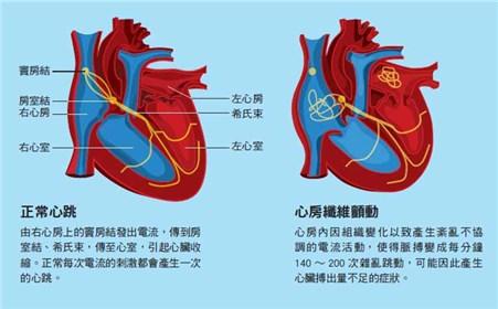 房颤的症状及治疗方法 房颤的治疗方法 房颤的症状