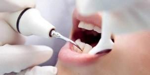 牙周炎怎么护理 患上牙周炎要怎样护理