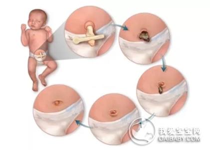 新生儿如何清理脐带 新生宝宝脐带如何护理