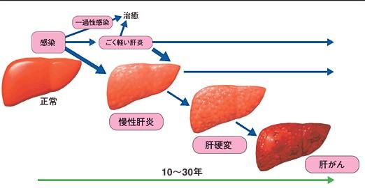 慢性乙型肝炎饮食禁忌 慢性肝炎有哪些禁忌事项