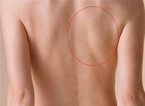 前胸和后背是怎么回事 前心后背痛是怎么回事