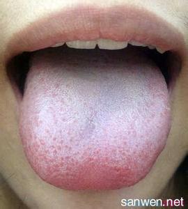 舌苔厚白怎么快速去除 舌苔是怎么形成的