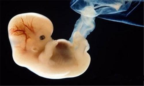 造成胎儿畸形的原因 什么原因会造成胎儿停育