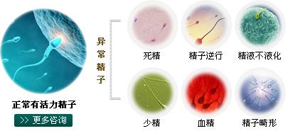 精子少吃什么能补回来 精子少怎么回事