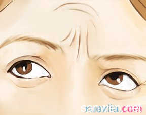 额纹是怎么形成的 眉间纹是怎么形成的