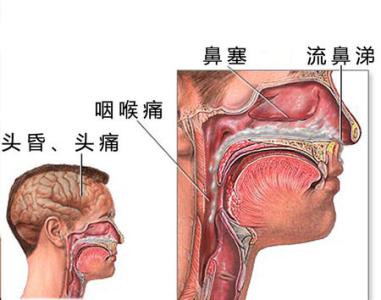 痰吞下去会怎样 痰是怎么形成的