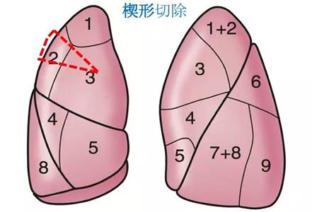 学会舍弃 哲理散文 学会解开心结的哲理