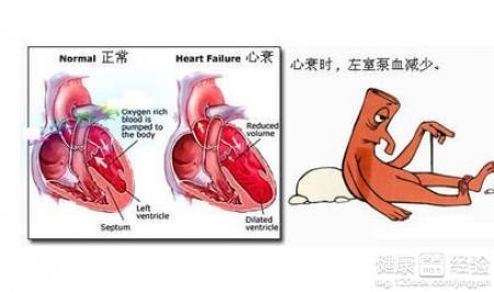 房颤是什么原因引起的 房颤是怎么形成的