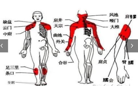 肩周炎的治疗方法 肩周炎是怎样形成的 肩周炎的治疗方法