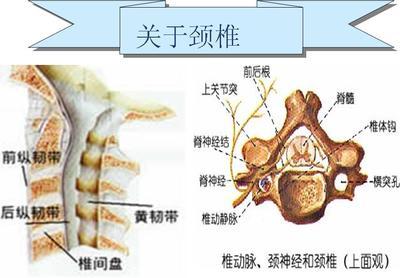 颈椎病治疗方法 颈椎病是怎么形成的 颈椎病的治疗方法(2)