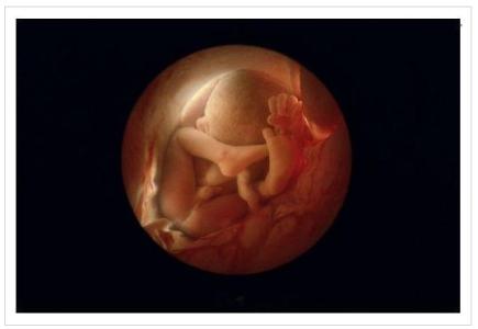 胎儿发育迟缓的原因 胎儿发育迟缓的原因有哪些