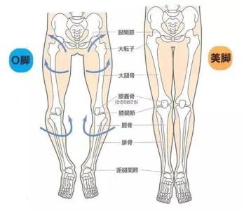罗圈腿是怎么形成的 宝宝罗圈腿是会如何形成的