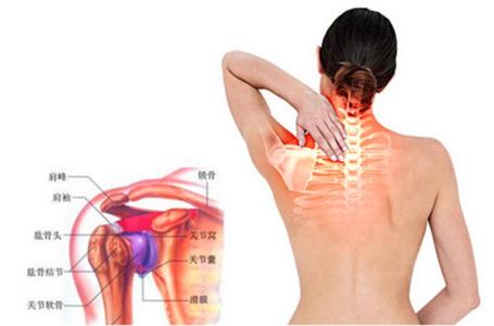 肩周炎缓解疼痛的方法 缓解肩周炎的5种方法
