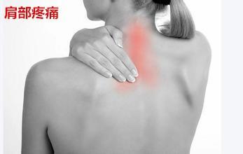 肩周炎的症状图片 肩周炎有什么症状