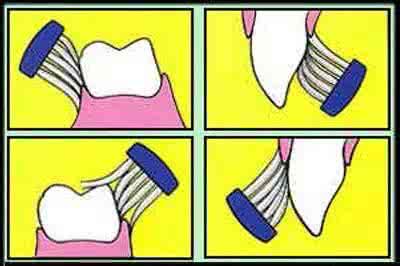 科学刷牙方法 最科学的刷牙方法是怎么样刷？