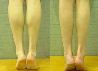 怎么减肌肉小腿 女生瘦小腿肌肉的简单方法