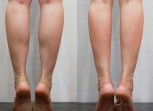 瘦小腿最有效的方法 怎么瘦小腿