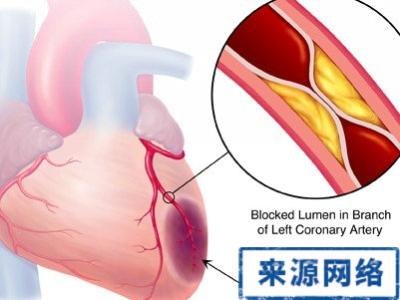 怎样保持性功能 夏季如何保持你心功能的正常