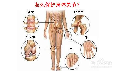 双膝骨关节炎健康教育 如何保护关节健康