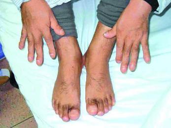 男性高颜值五官特征 怎样从脚部特征看疾病_脚“颜值”过关吗