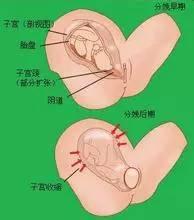 阴道出血的原因有哪些 阴道出血的常见原因有哪些