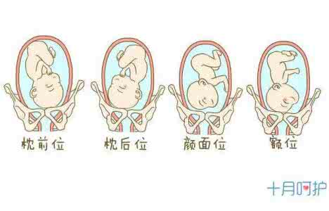 胎位roa是男孩女孩 胎位roa是什么意思