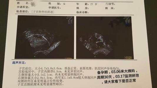 卵泡多大算成熟 卵泡多大才算成熟?