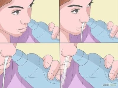 盐水洗鼻子治疗鼻炎 过敏可用盐水洗鼻子