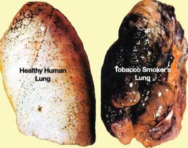 保养卵巢的食疗方法 保养吸烟肺的食疗方法