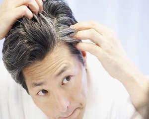 治疗白头发最佳方法 治疗白头发的方法