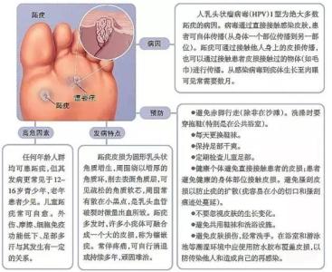 鸡眼中医解释 鸡眼是怎么形成的中医解释