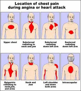 心脏病发作急救 心脏病发作的急救处理方法